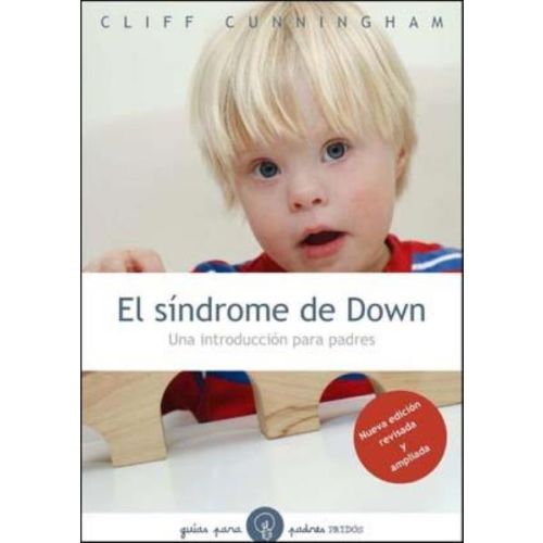 SINDROME DE DOWN, EL