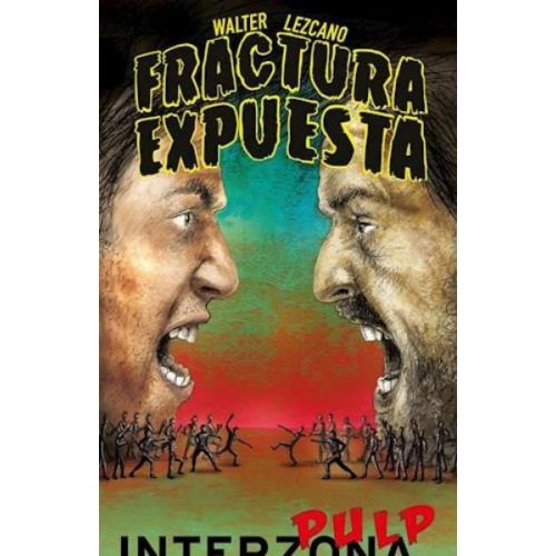 FRACTURA EXPUESTA